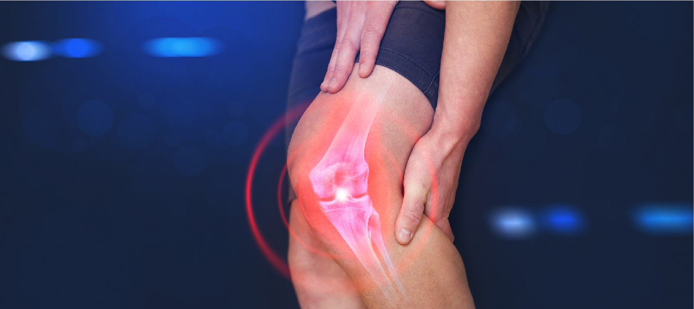 How Long Does Knee Replacement Surgery Take?