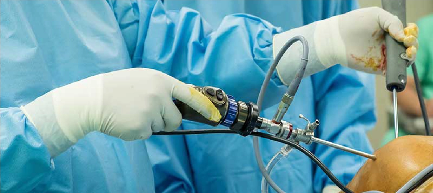 Robotic Knee Replacement Surgery in Delhi, India | Dr. Ishwar Bohra