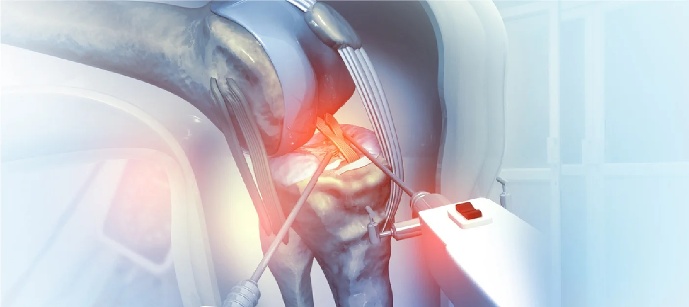 Robotic Vs. Traditional Knee Replacement Surgery