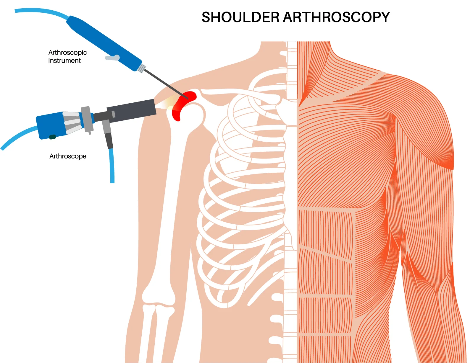 Essential Insights On Shoulder Arthroscopy: What You Need to Know