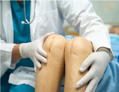 Effective Tips for Easing Pain After Knee Replacement Surgery