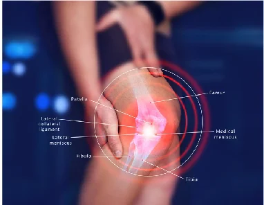 How Much Does ACL Surgery Cost in Delhi, India?