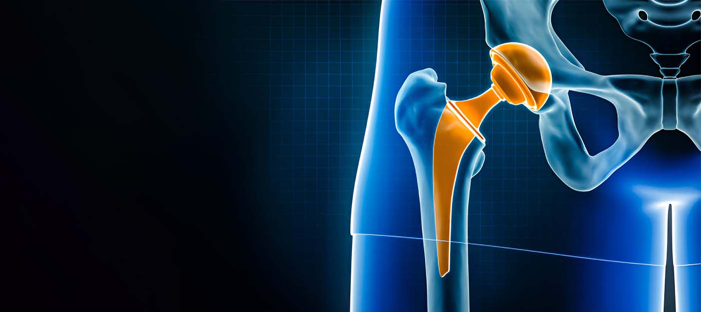 How to Choose the Best Hip Replacement Doctor in Delhi: A Complete ...