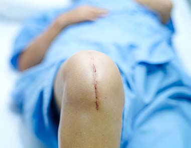 Types Of Knee Surgery And Their Recovery Times: What You Need To Know