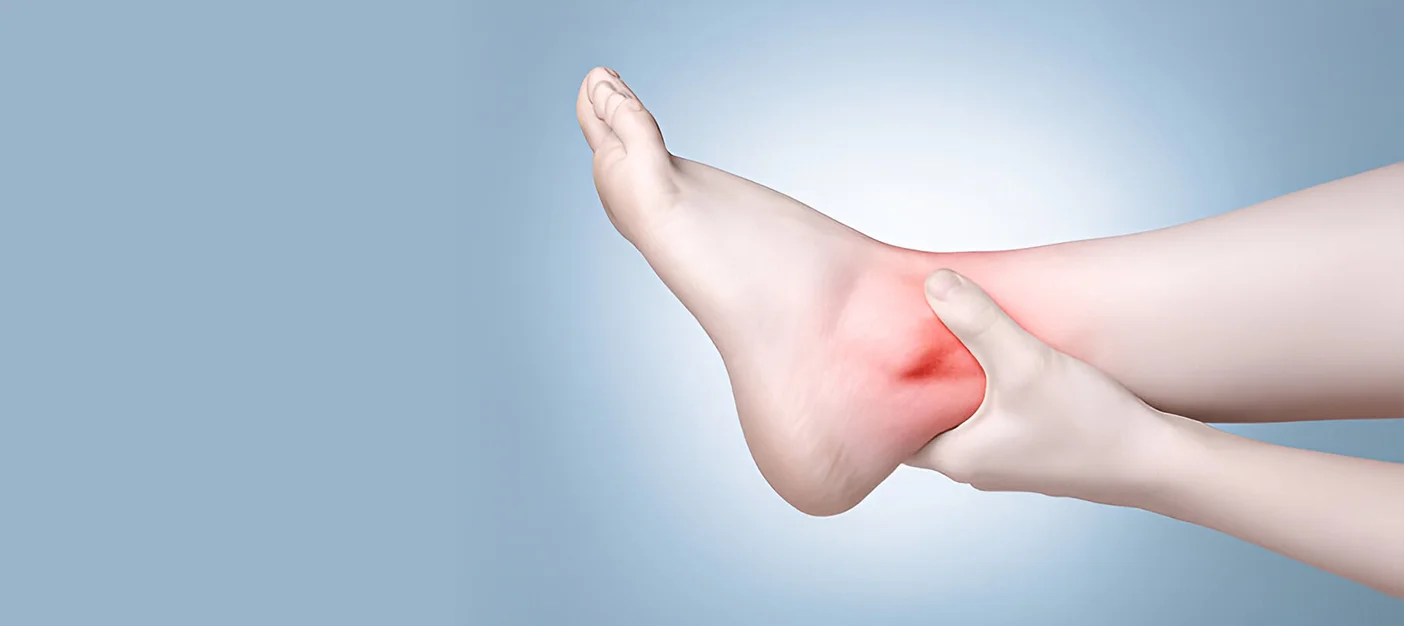Difference Between Ankle Sprain And Ankle Strain?