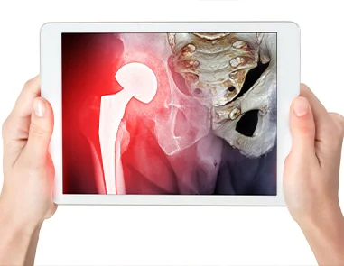 Top Hip Replacement Surgery In Dwarka: Leading Experts & Advanced Care