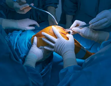 Find the Leading Revision Knee Replacement Surgeon in Dwarka