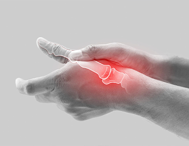 Managing Arthritis at Work: Staying Productive with Chronic Pain