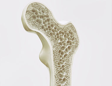 Protecting Fragile Bones: Key Strategies for Lifelong Strength and Mobility