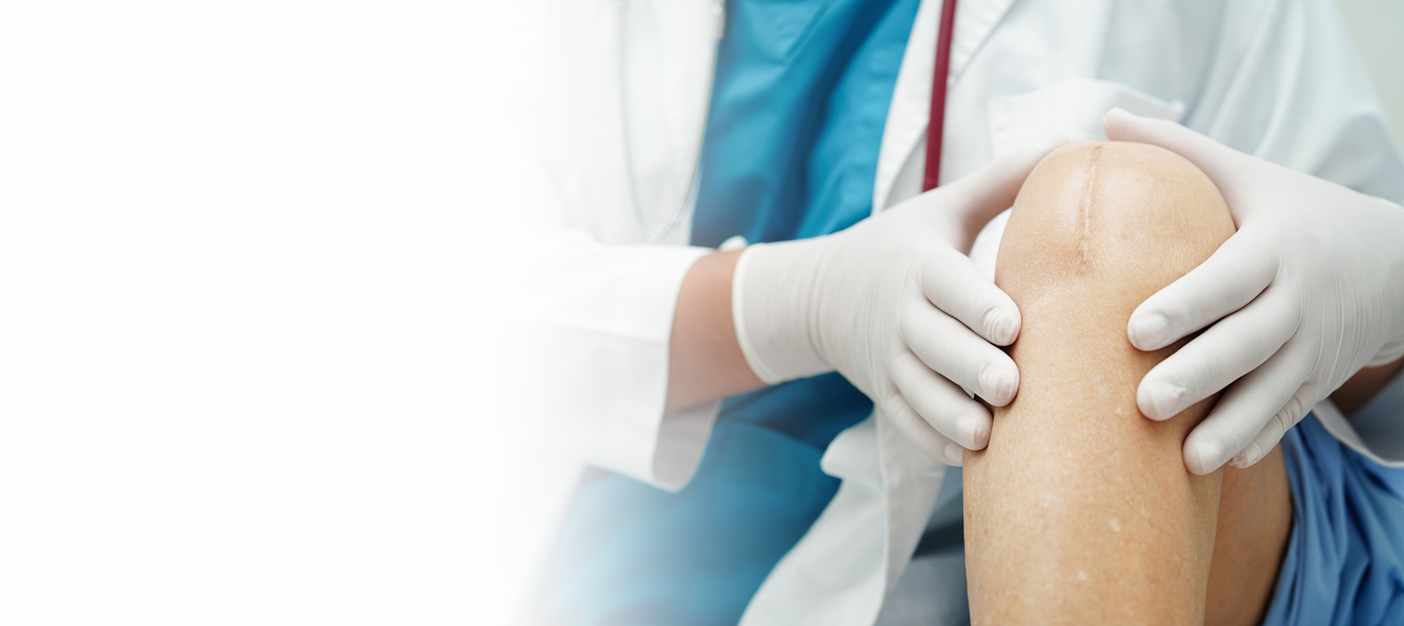 Knee Replacement Surgery Cost in Delhi 2026 – Price Guide