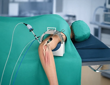 Elbow Arthroscopy Surgery: Cost, Risks & Recovery Timeline