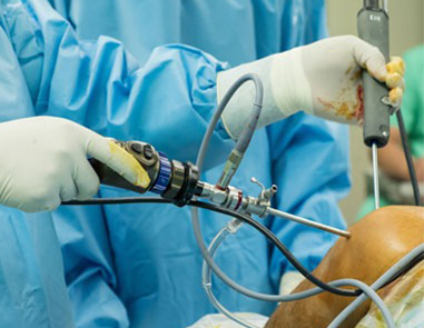Shoulder Arthroscopy Surgery in Dwarka