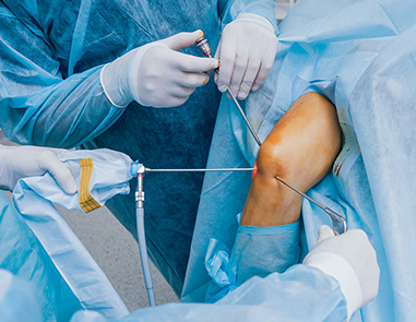 Knee Replacement vs Arthroscopy: Which Treatment Is Right for You?