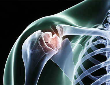 Best Shoulder Replacement Surgery in Delhi: Advanced Procedure, Cost, Recovery & Expert Orthopedic Care