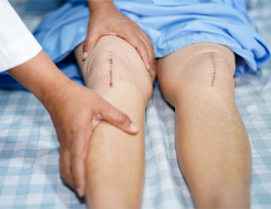 Best Knee Replacement Surgeon In Delhi (2026) – Dr. Ishwar Bohra